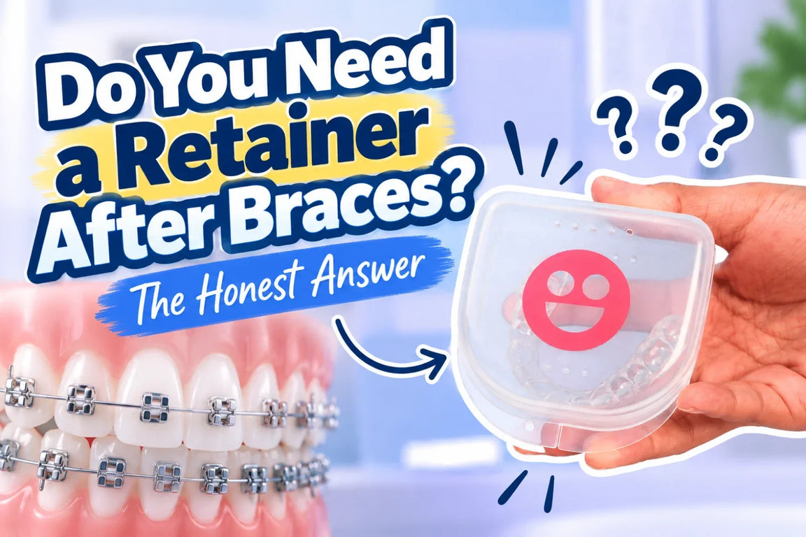 Do You Need a Retainer After Braces? The Honest Answer