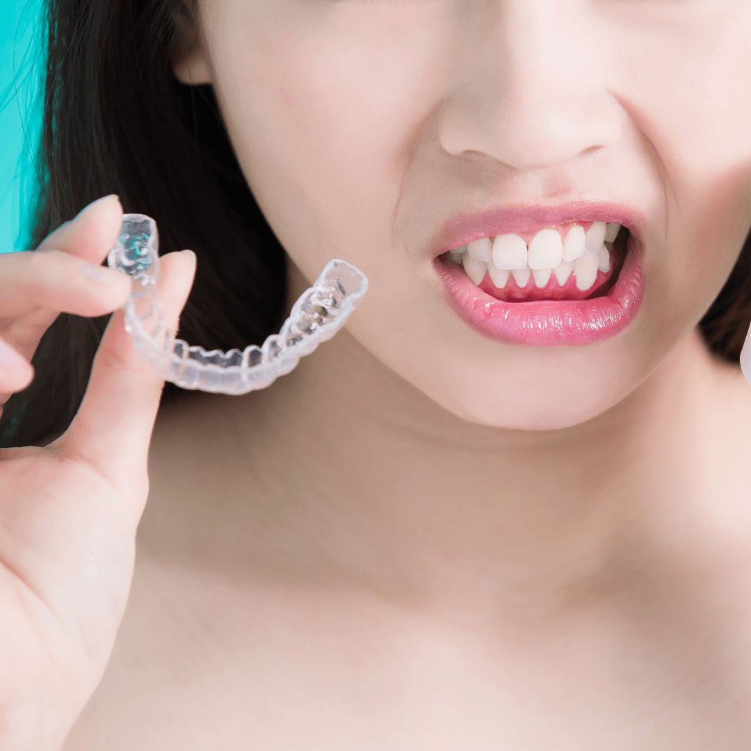 Why Do Custom Night Guards Cost So Much?