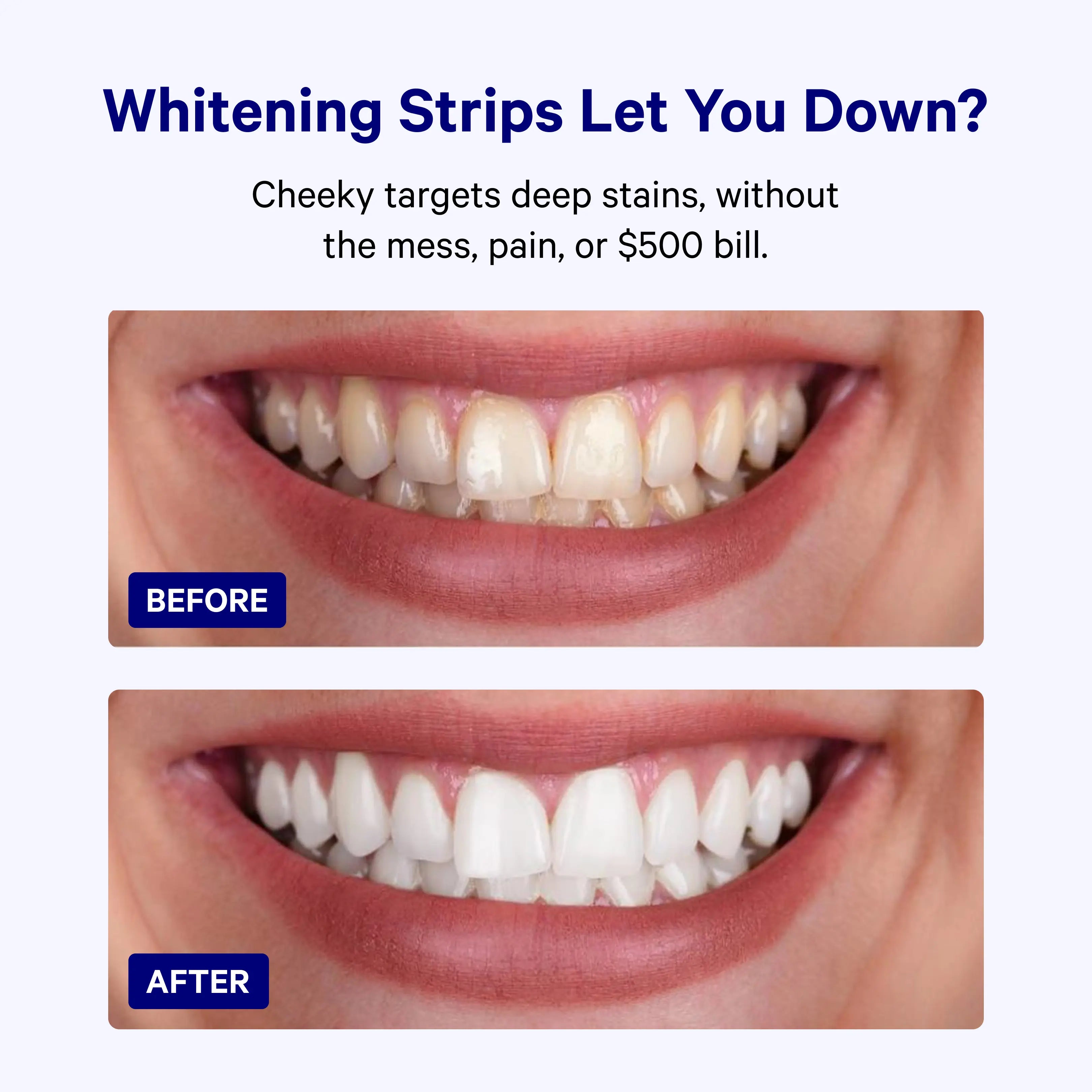 Whitening Kit image 2