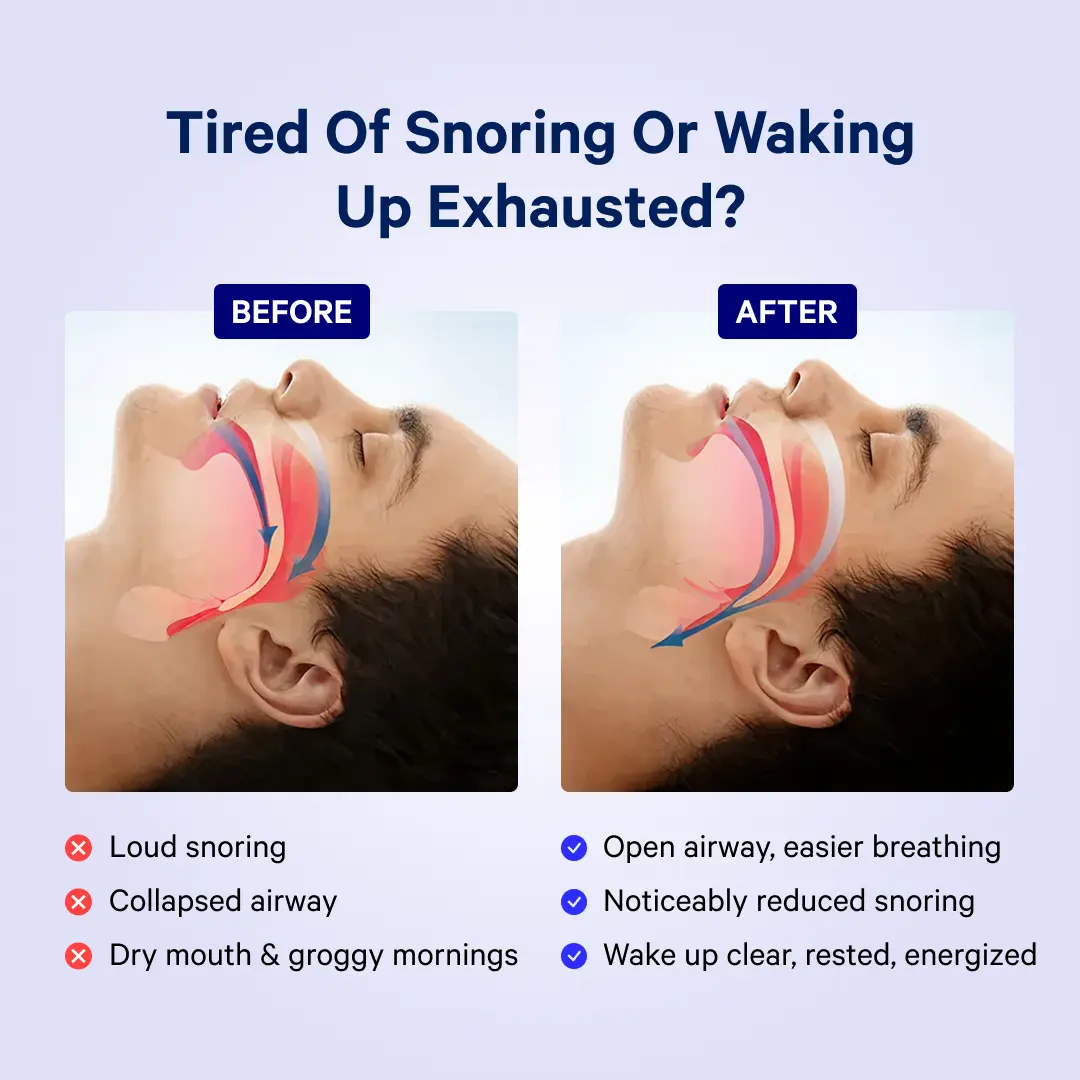 Sleep apnea guard slide