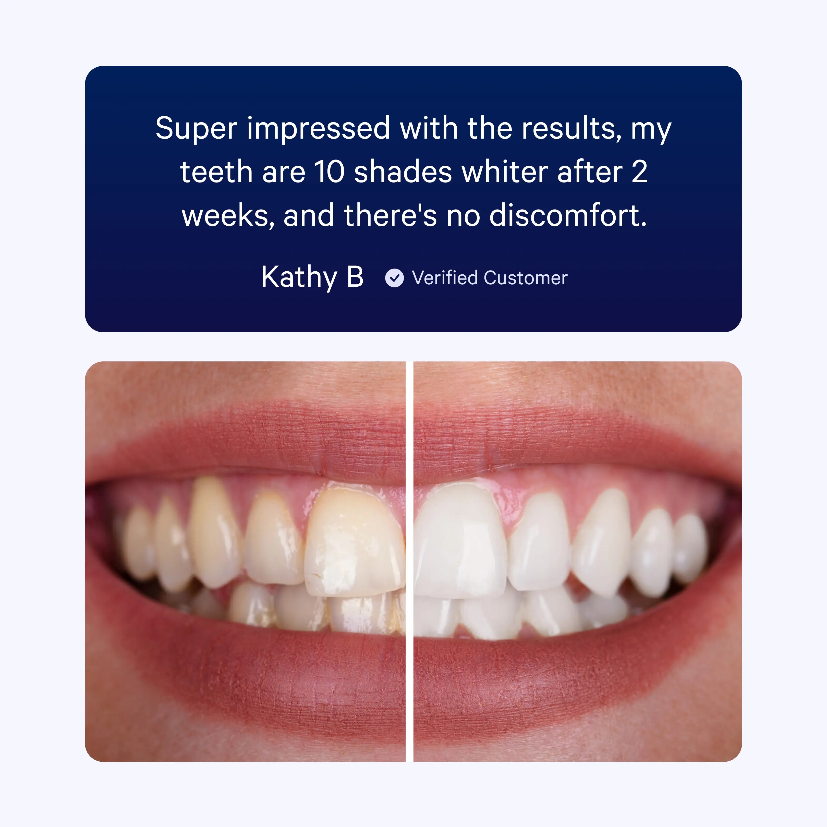 Whitening Kit image 6