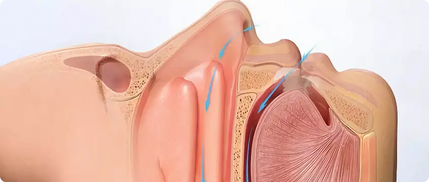 Repositions the Tongue